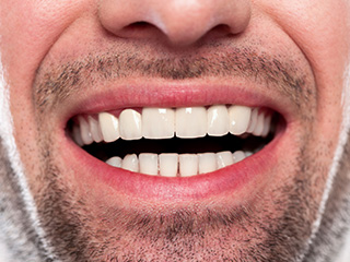 Closeup of man with healthy smile