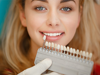 Woman's teeth compared with shading chart