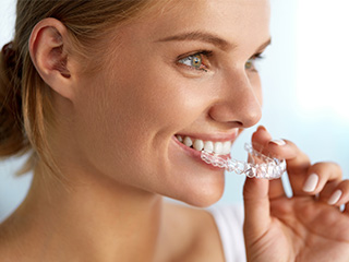 Woman placing Invisalign tray