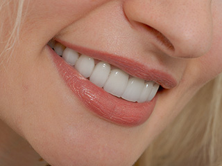 Closeup of beautiful smile