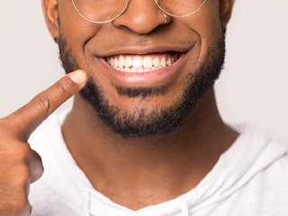 man with dental bridge in Edison, NJ pointing to his smile