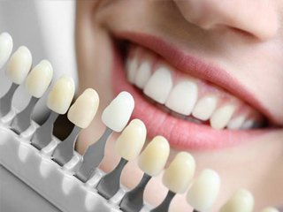 Tooth enamel color matching guide