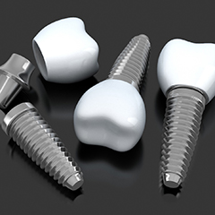 three dental implant posts with abutments and crowns