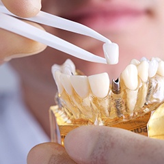 dentist placing a crown on a dental implant