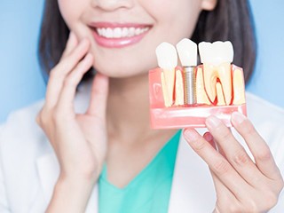 dentist holding a dental implant model