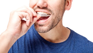 Man with Invisalign