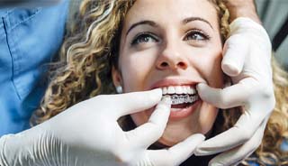 Closeup of patient getting Invisalign in Edison