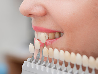 edison porcelain veneers cosmetic dentist resnick rosenfeld dds teeth shading chart