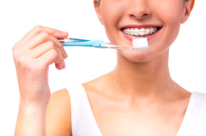 woman with braces brushing teeth