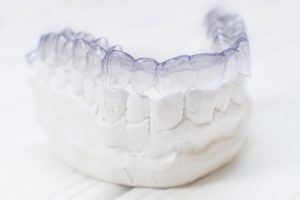 Invisalign in Edison on dental mold