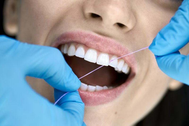 Dentist flossing dental implants