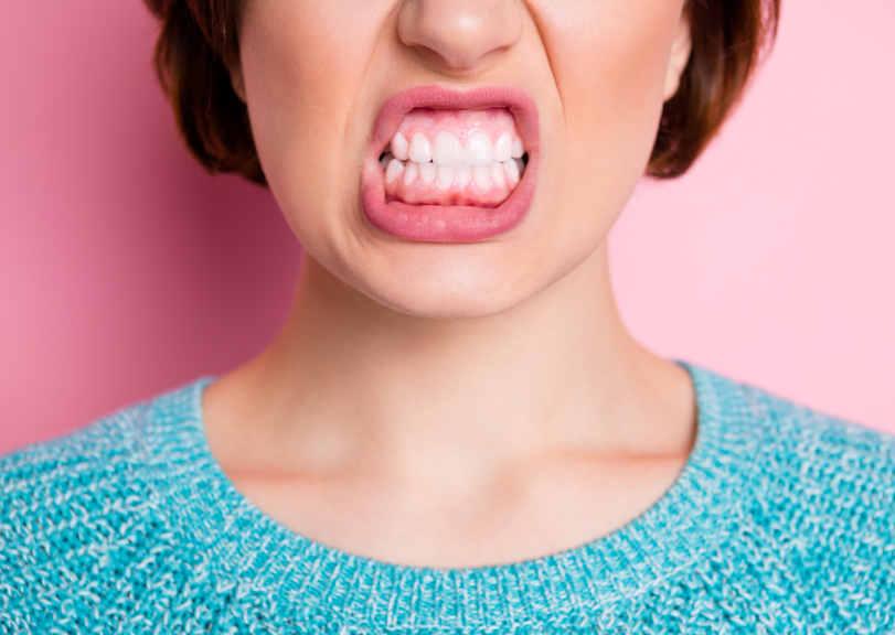 Close up of woman's smiling showing gums